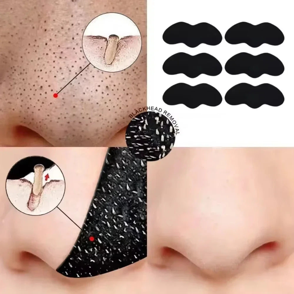 Unisex Deep Cleansing Nose Strips for Acne & Blackhead Removal Shrink Pore Nose Black Head Stickers Refreshing Skin Care Patch